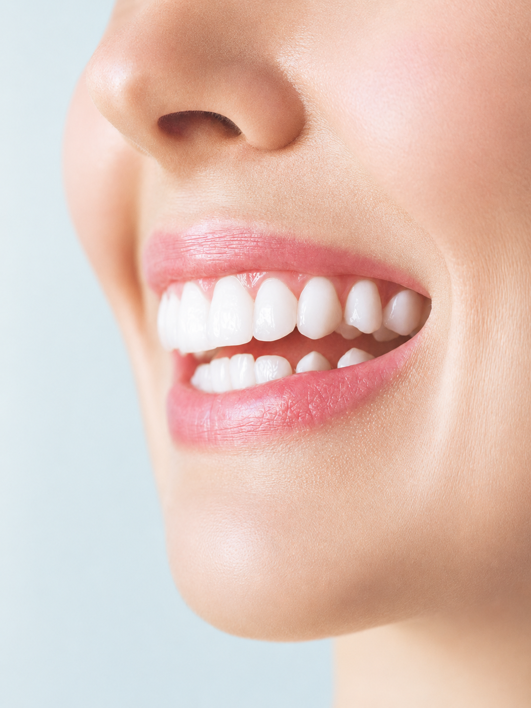 Clareamento Dental
