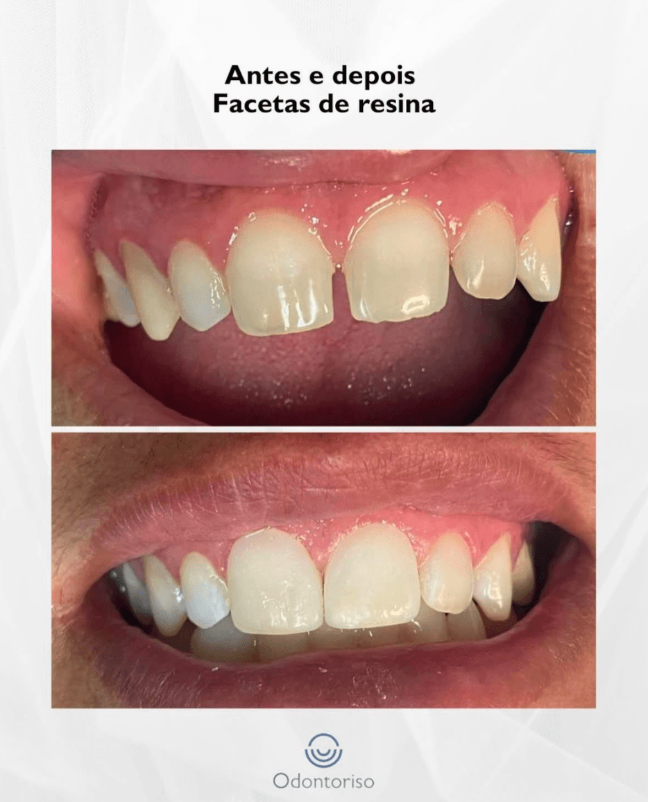 Resultado 10