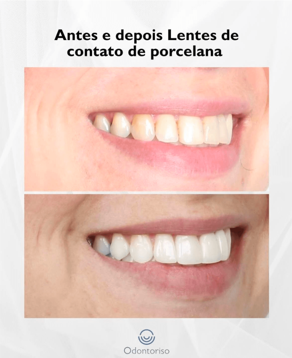 Resultado 2