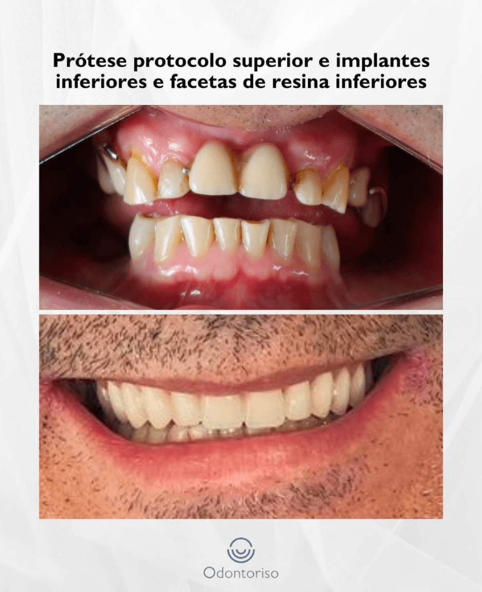 Resultado 4
