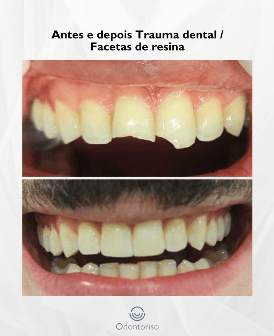 Resultado 8